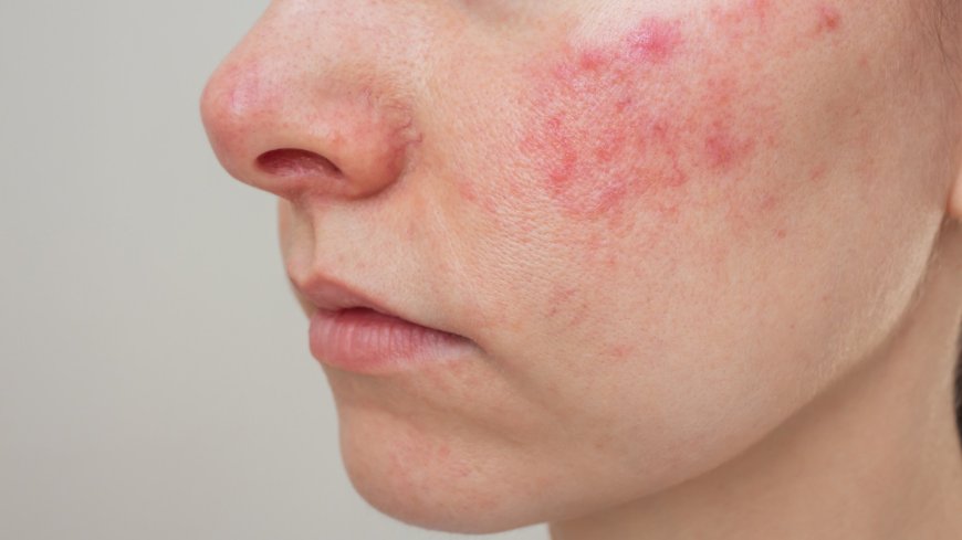 My face is red and itchy all the time – I’ve spent £100s trying to fix it but nothing works --[Reported by Umva mag]