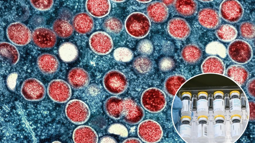 UK preparing for worst-case mpox scenario, officials warn – as vaccines stockpiled amid global surge of killer strain --[Reported by Umva mag]