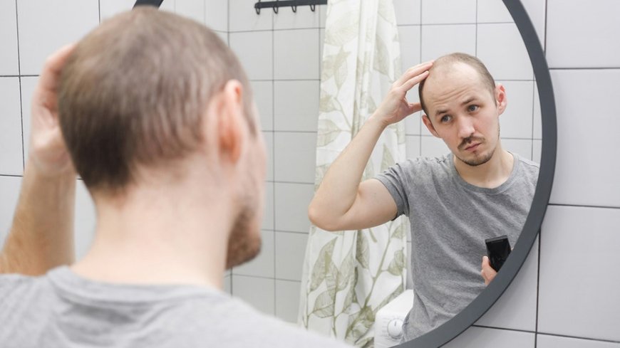 These 5 balding and hair loss treatments could help ensure a healthy scalp, experts say --[Reported by Umva mag]