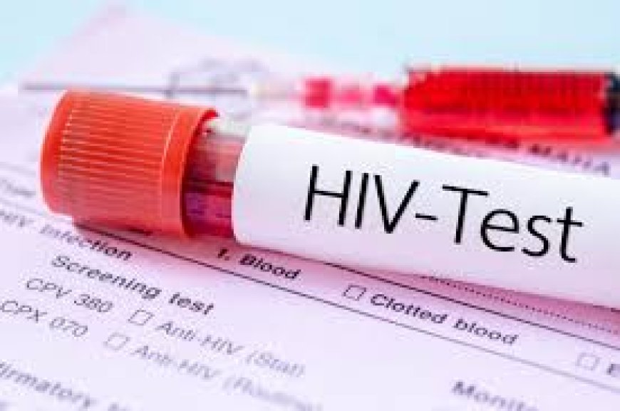 Over 3,100 young African women infected with HIV weekly – UN --[Reported by Umva mag]