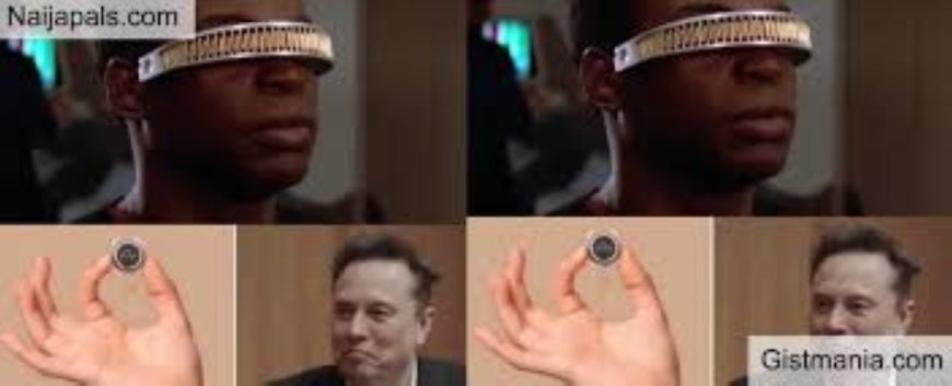 Blindness: Could Elon Musk’s Neuralink device offer medical breakthrough? --[Reported by Umva mag]