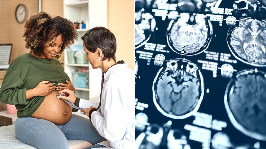 During pregnancy, a woman's brain experiences 'profound changes,' new study finds --[Reported by Umva mag]