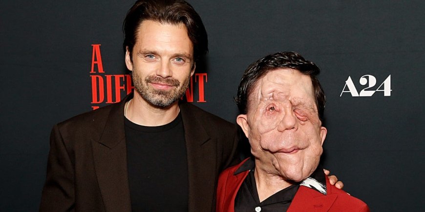 Everything to know about Adam Pearson, Sebastian Stan's scene-stealing costar in the A24 thriller 'A Different Man' --[Reported by Umva mag]