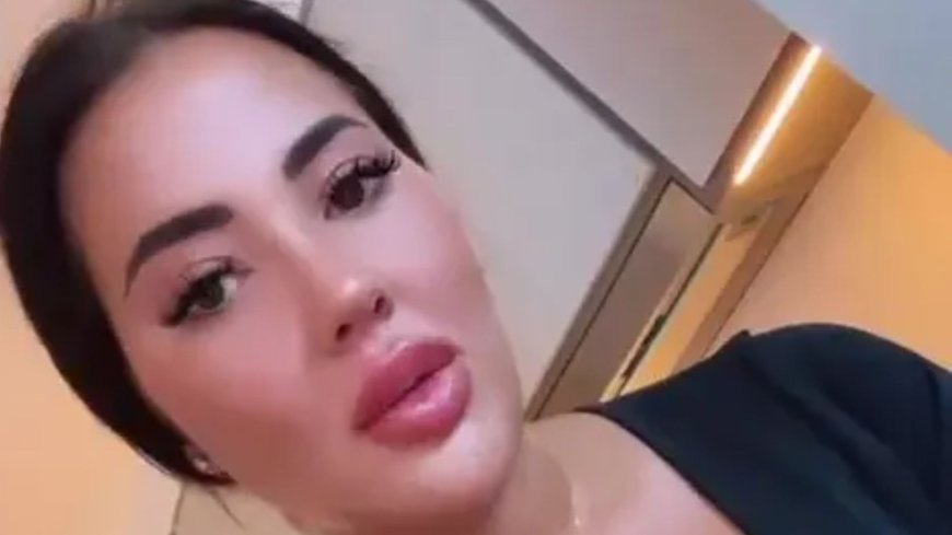 Towie star Yazmin Oukhellou dissolves 10 years of filler from face as fans say ‘you look stunning now’ --[Reported by Umva mag]