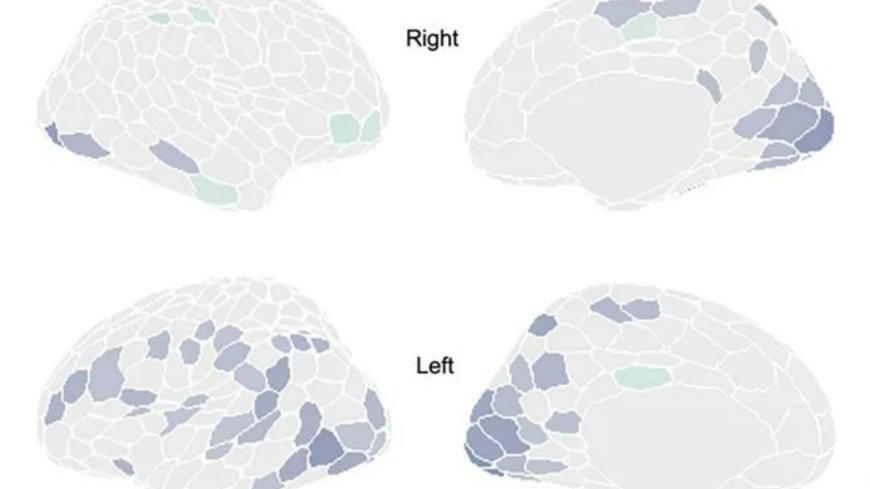 Men’s brains SHRINK by 8pm everyday – before resetting overnight, scientists discover --[Reported by Umva mag]