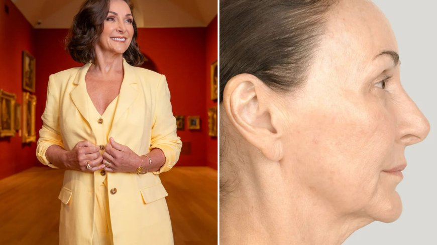 Strictly’s Shirley Ballas reveals results of new facelift saying non-surgical procedure has ‘shaved 30 years off’ --[Reported by Umva mag]