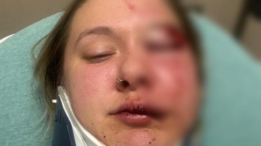 Woman just dropped off by Uber brutally beaten in random attack --[Reported by Umva mag]