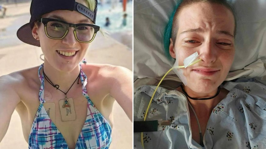 Mum-of-two, 32, with ‘vampire disease’ vomits 30 times a day and lives in fear of dropping dead at dinner --[Reported by Umva mag]