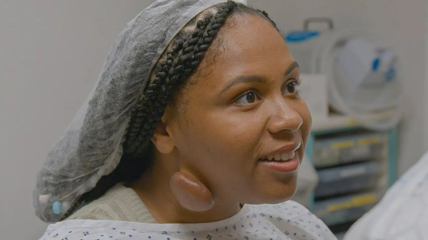 Watch as woman, 28, plagued by giant skin growth undergoes life-changing surgery on The Bad Skin Clinic --[Reported by Umva mag]