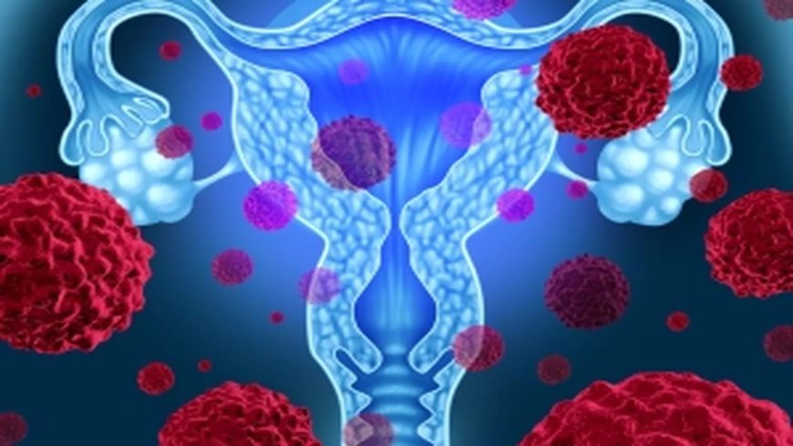 New cervical cancer treatment cuts risk of death by 40% in ‘biggest breakthrough in 20 years’ --[Reported by Umva mag]