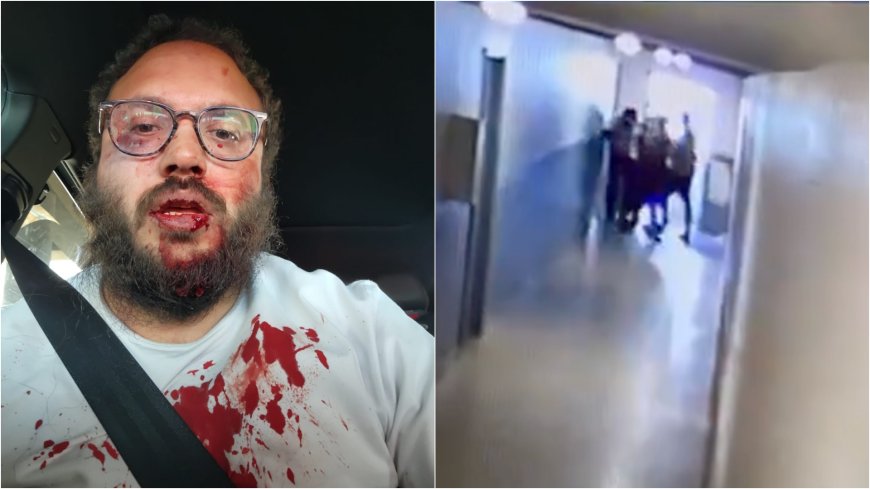 SHOCK VIDEO: Aurora Apartment Worker Beaten Bloody by Venezuelan Tren de Aragua Gang Members --[Reported by Umva mag]