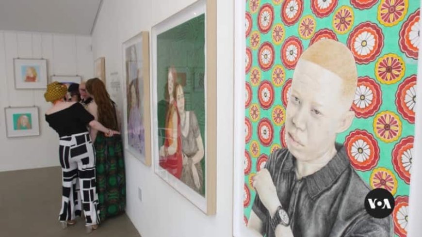 South African artists, influencers with albinism fight stigma --[Reported by Umva mag]