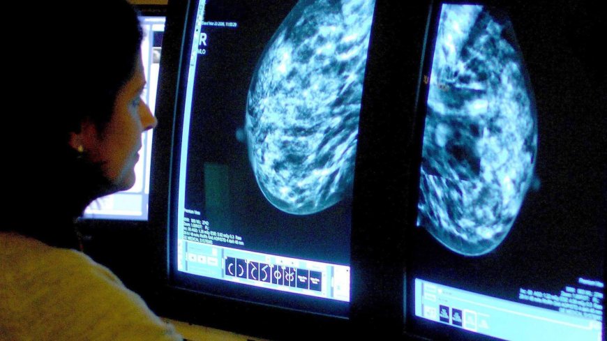 Urgent warning as thousands of women could be living with undetected breast cancer – are you at risk? --[Reported by Umva mag]