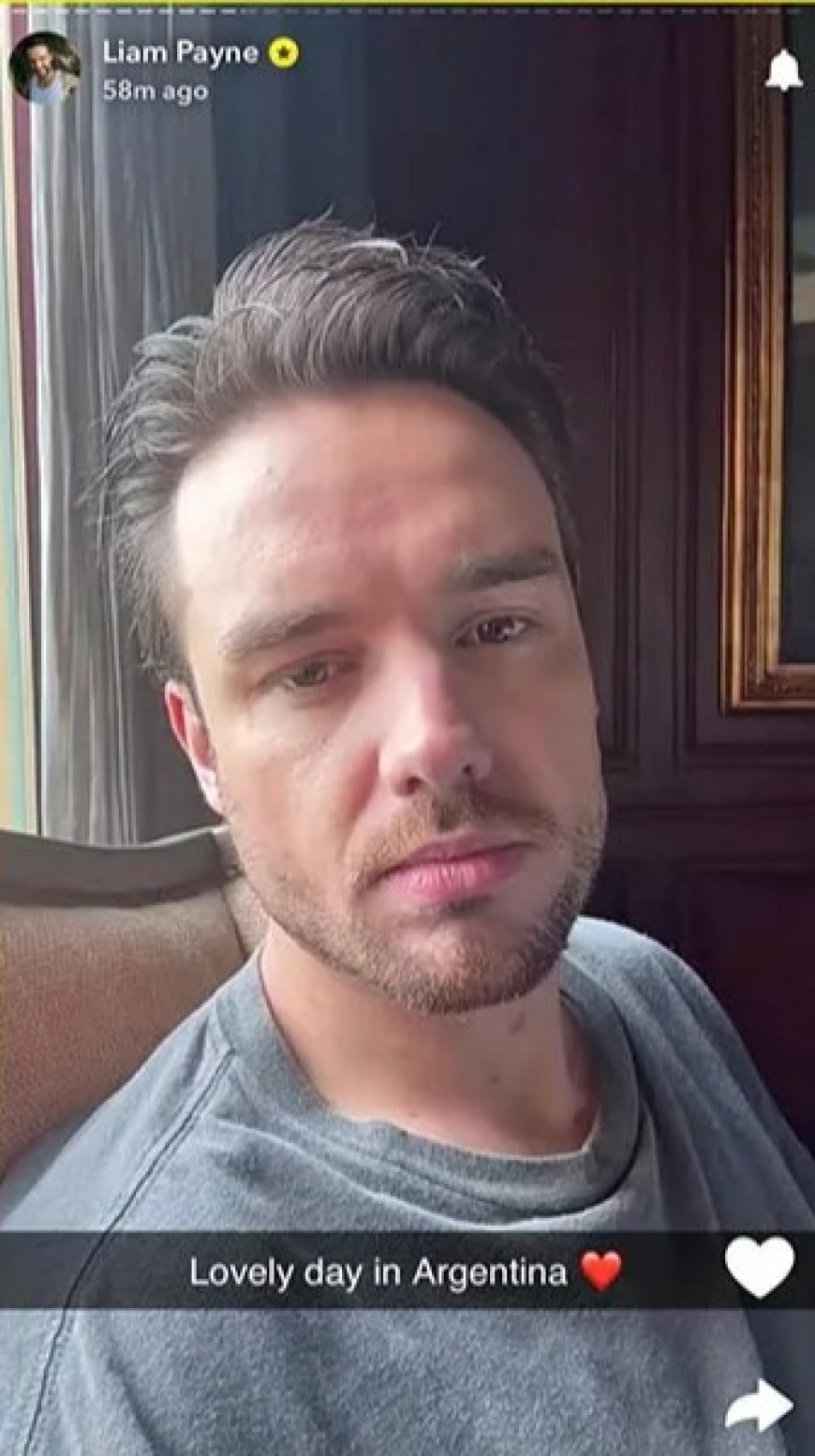 Liam Payne’s cause of death released & heartbreaking 911 call revealed after ‘erratic’ star ‘had to be carried to room’ --[Reported by Umva mag]