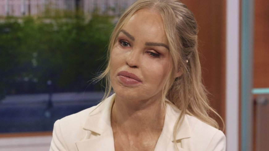 Katie Piper supported by ITV stars as she slams shocking message from troll --[Reported by Umva mag]